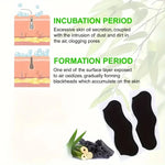 Anti-Blackhead Nose Peel Strips